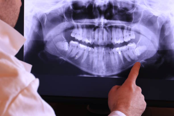 Best Emergency TMJ Treatment in East Whittier, CA