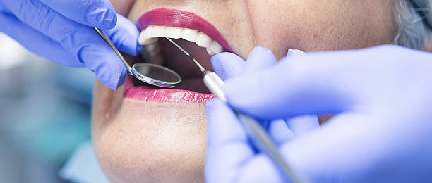 Best Emergency Dental Care for Broken or Chipped Teeth in East Whittier, CA